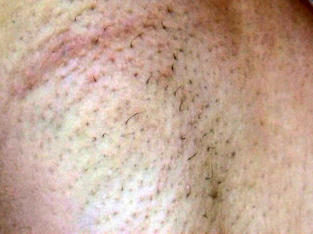 サンプル画像 17