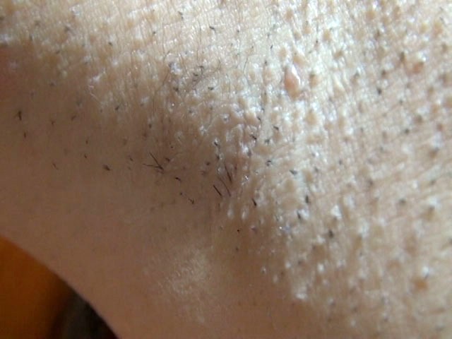 サンプル画像 11