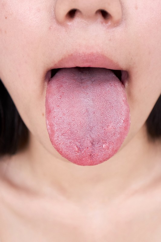 サンプル画像 17