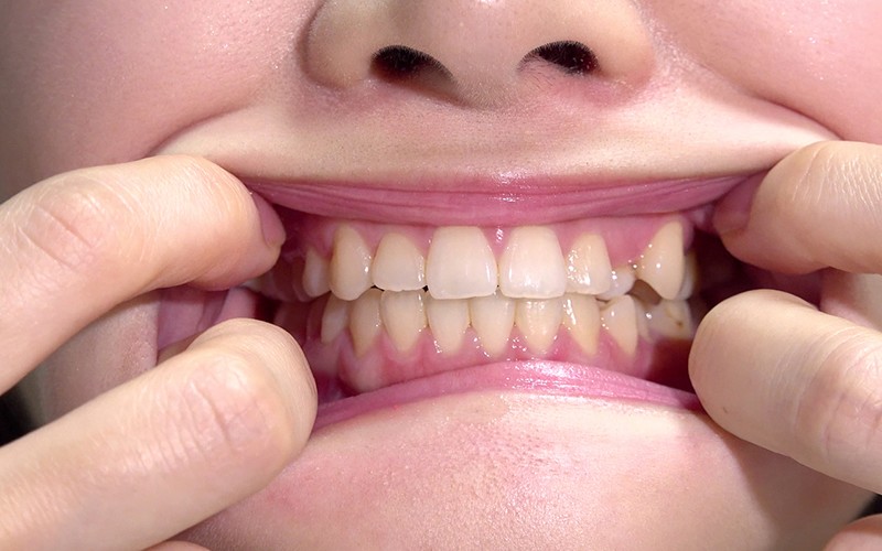 サンプル画像 11