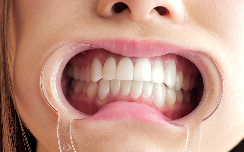 サンプル画像 11