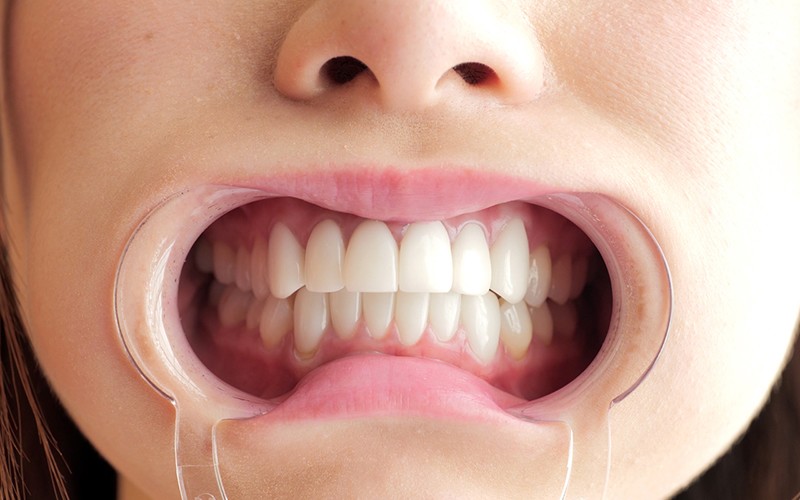 サンプル画像 10