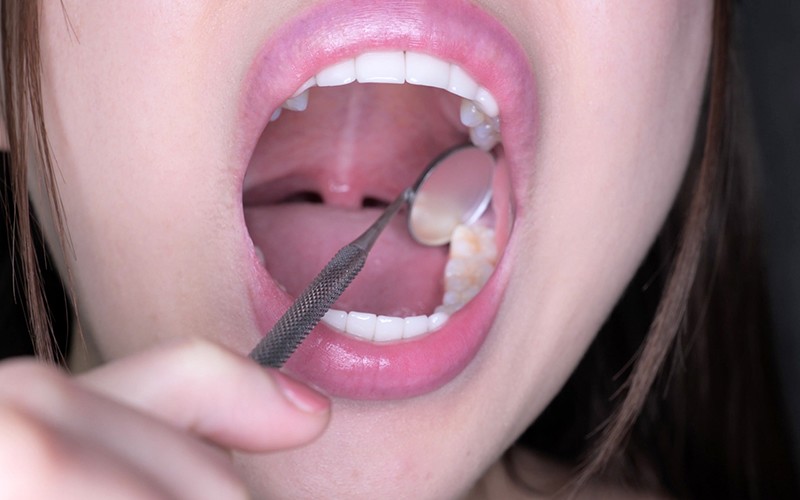 サンプル画像 18