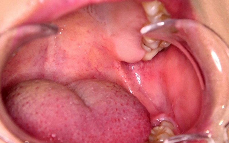 サンプル画像 11