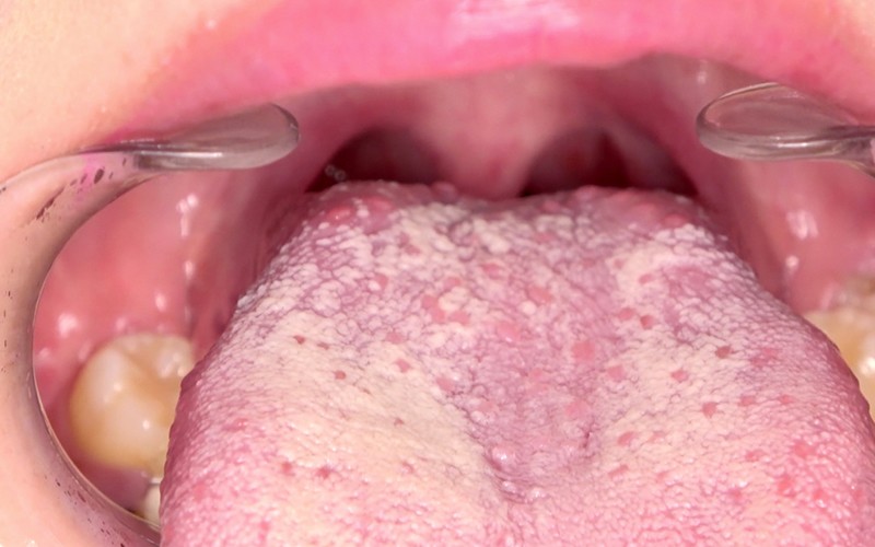 サンプル画像 12