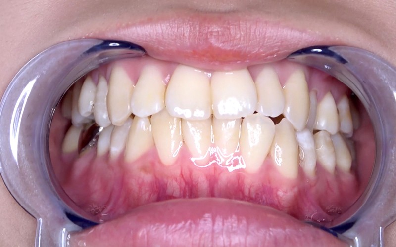 サンプル画像 11