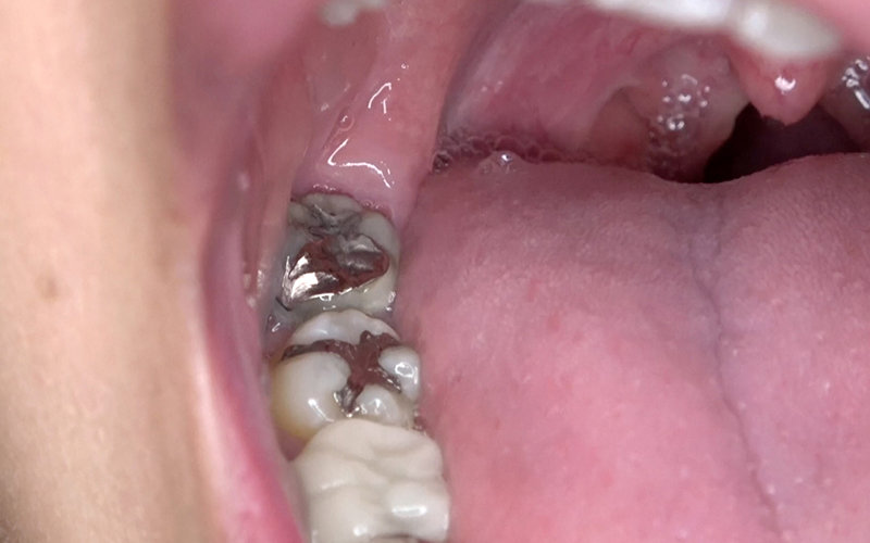 サンプル画像 11