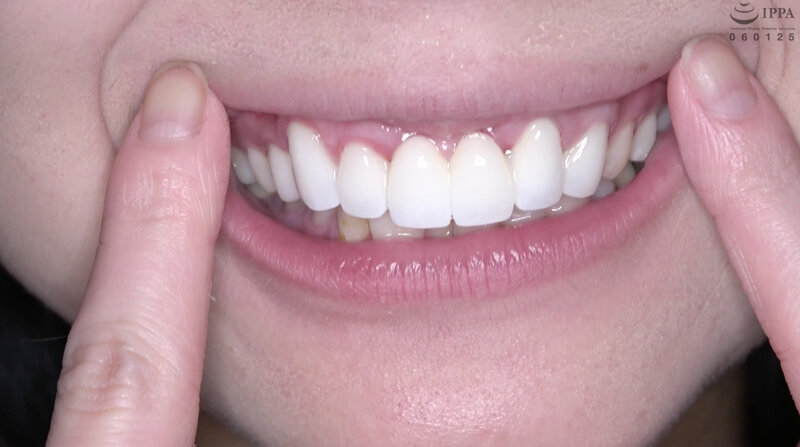 サンプルプレビュー