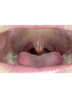 パッケージ画像