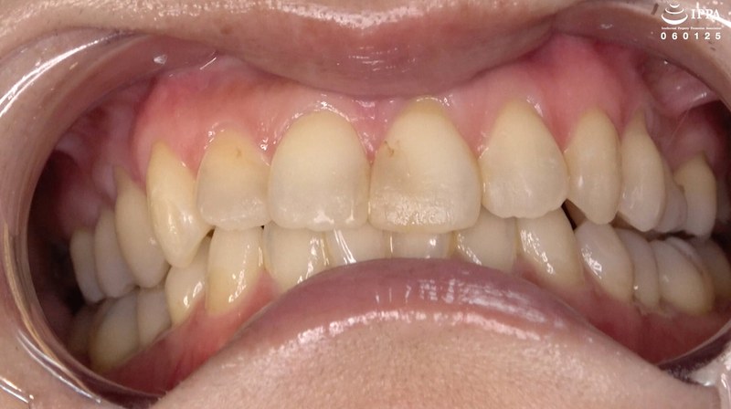 サンプルプレビュー