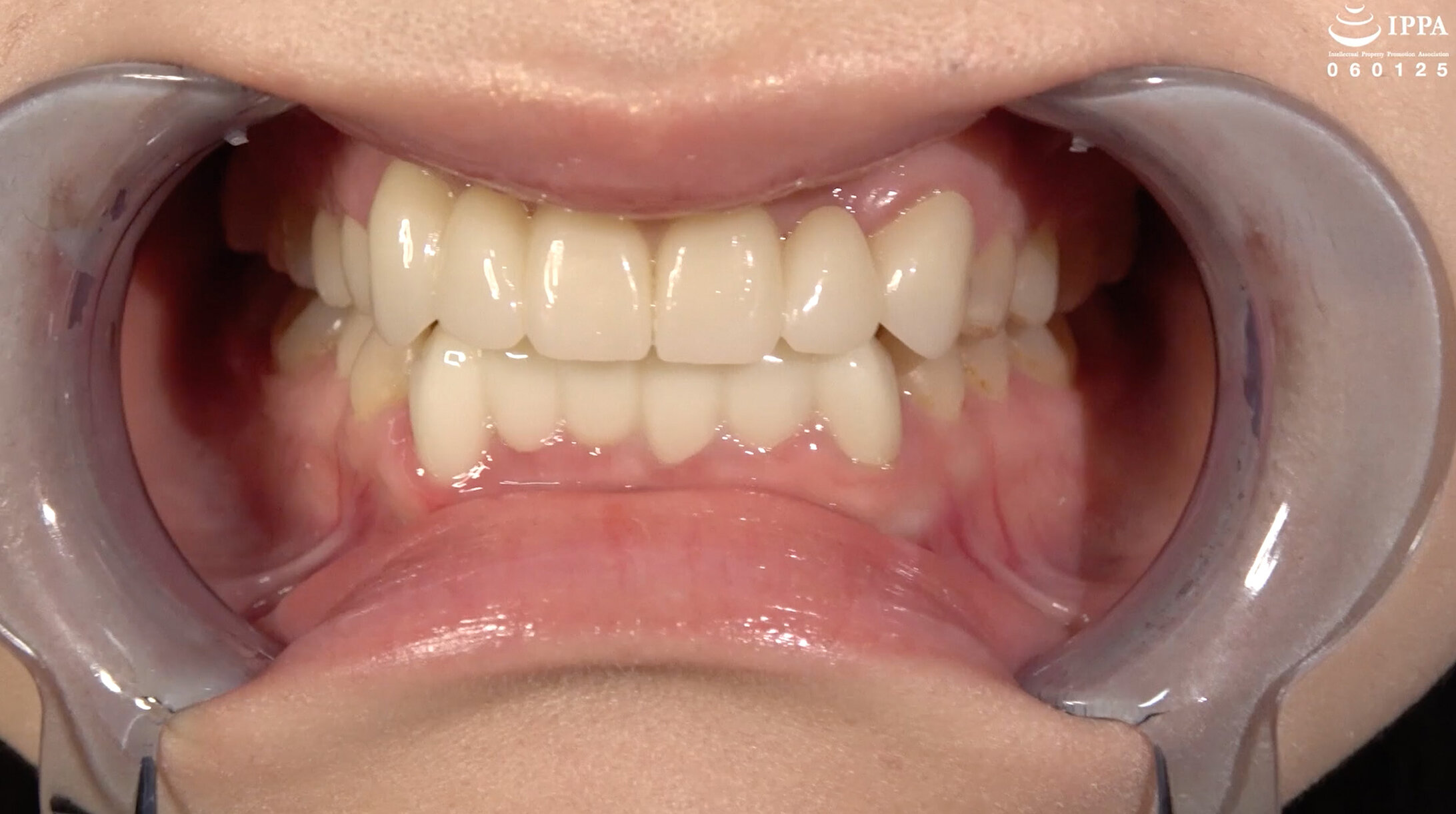 サンプルプレビュー