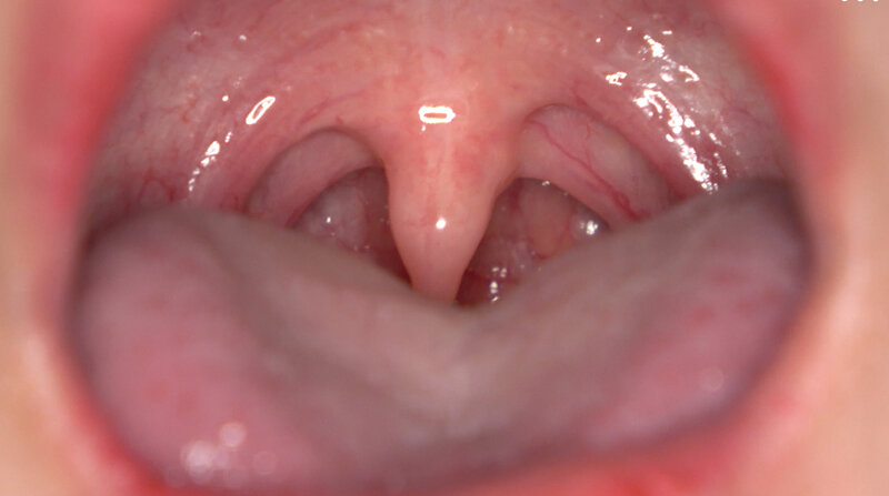 パッケージ画像