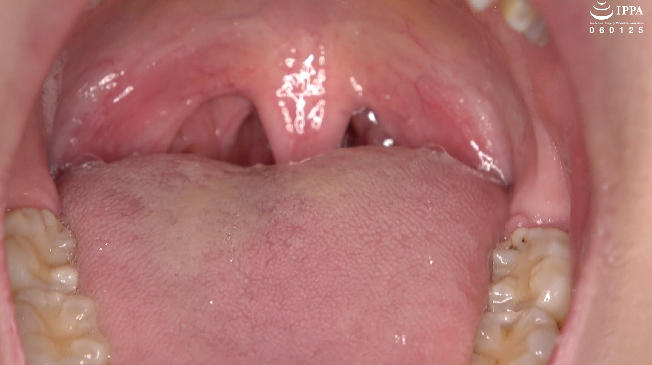 サンプルプレビュー