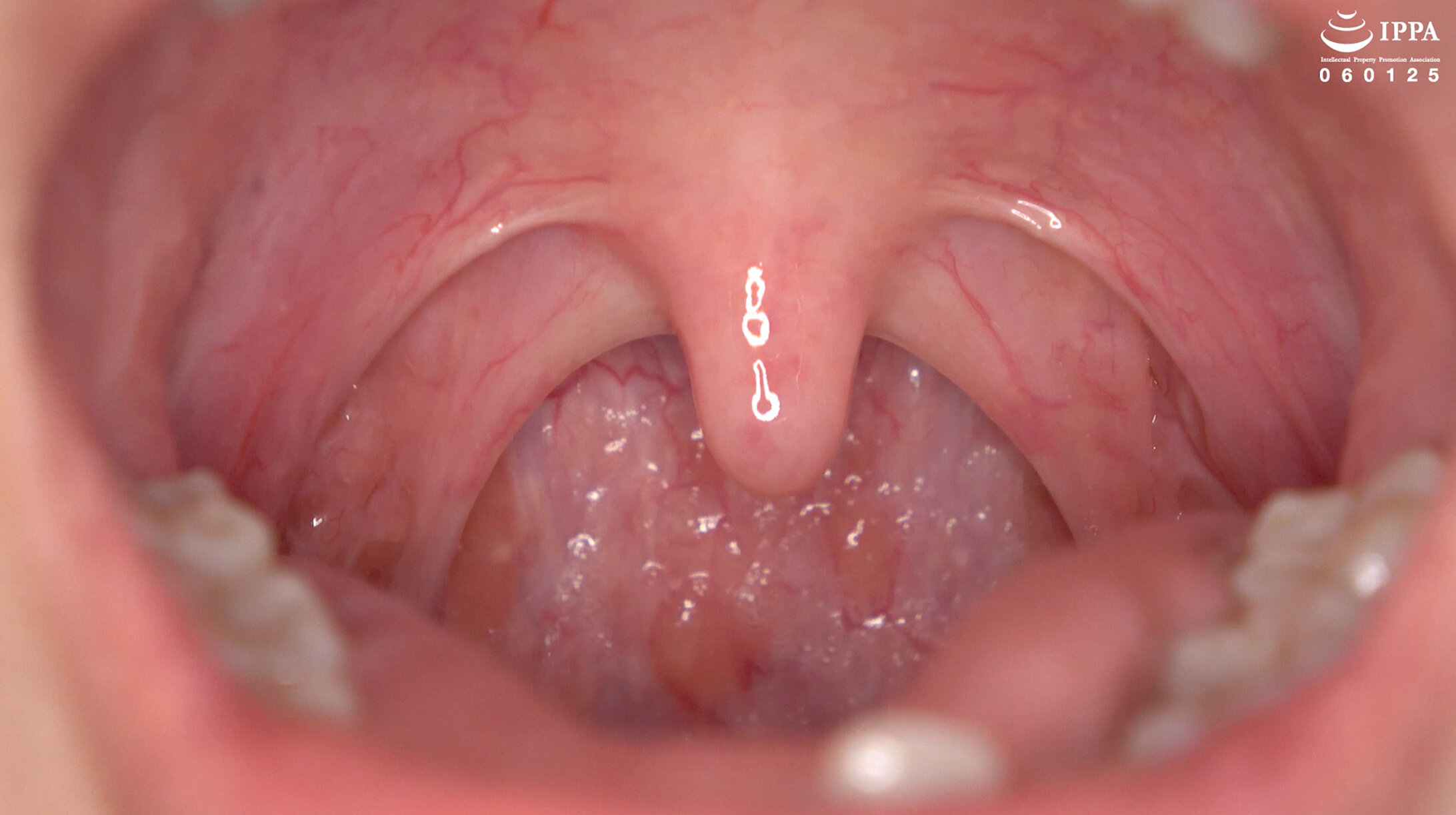 パッケージ画像