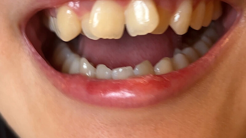 サンプル画像 11