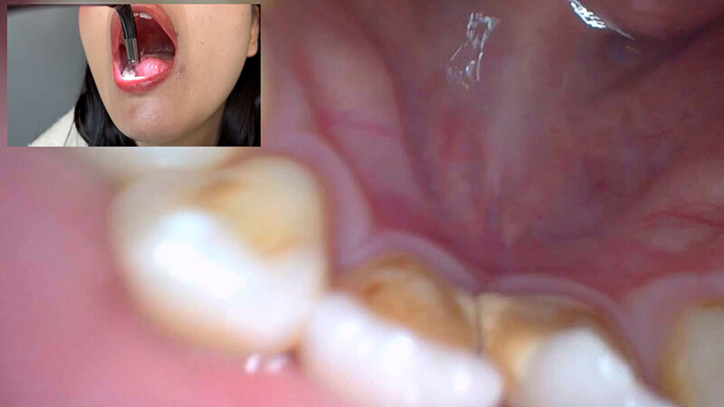 サンプル画像 15