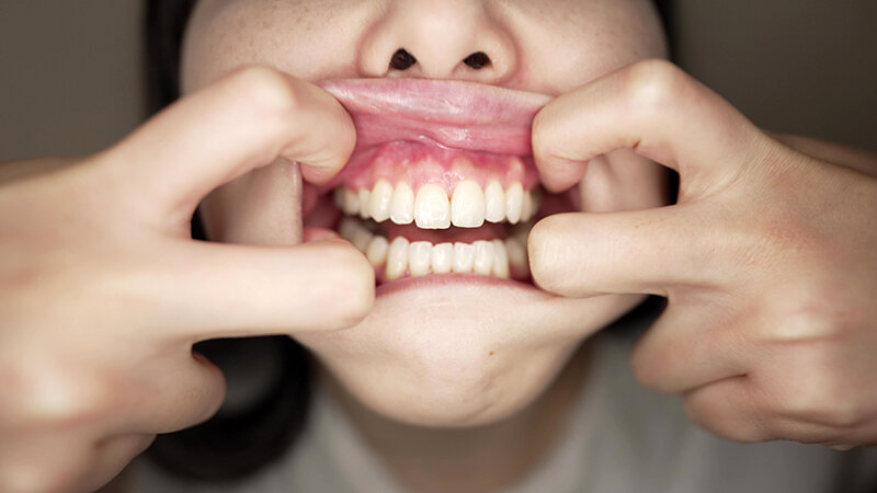 サンプル画像 11