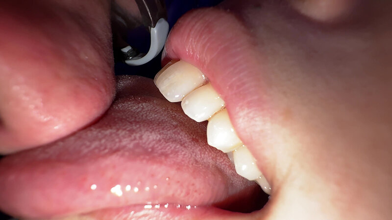 サンプル画像 11