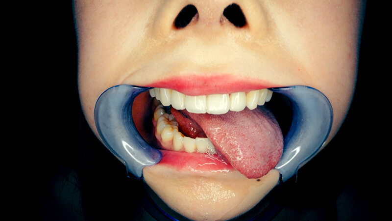 サンプル画像 19